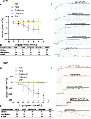 Specific dilation pattern in placental circulation and the NO/sGC role in preeclampsia placental vessels